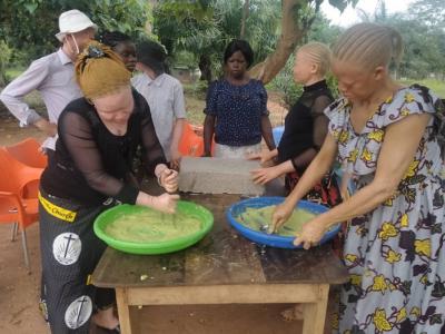 R.D. del Congo: inclusión de jóvenes con albinismo